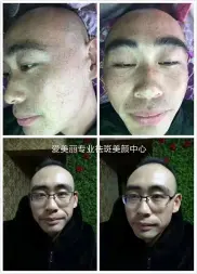 荆州区轻美素颜美容中心·爱美丽5天专业祛斑美颜中心