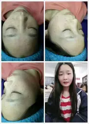 荆州区轻美素颜美容中心·爱美丽5天专业祛斑美颜中心
