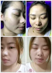 荆州区轻美素颜美容中心·爱美丽5天专业祛斑美颜中心