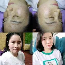 荆州区轻美素颜美容中心·爱美丽5天专业祛斑美颜中心